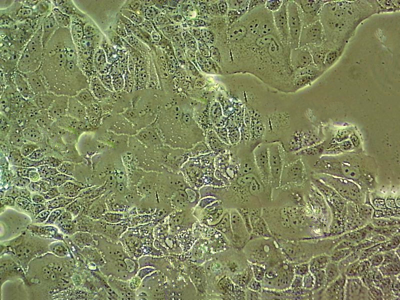 KYSE-510 Cell|人食管鳞癌细胞