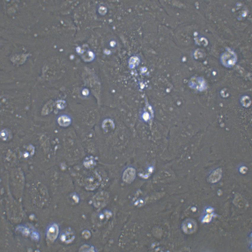 OVCA433 Cell|人卵巢癌细胞