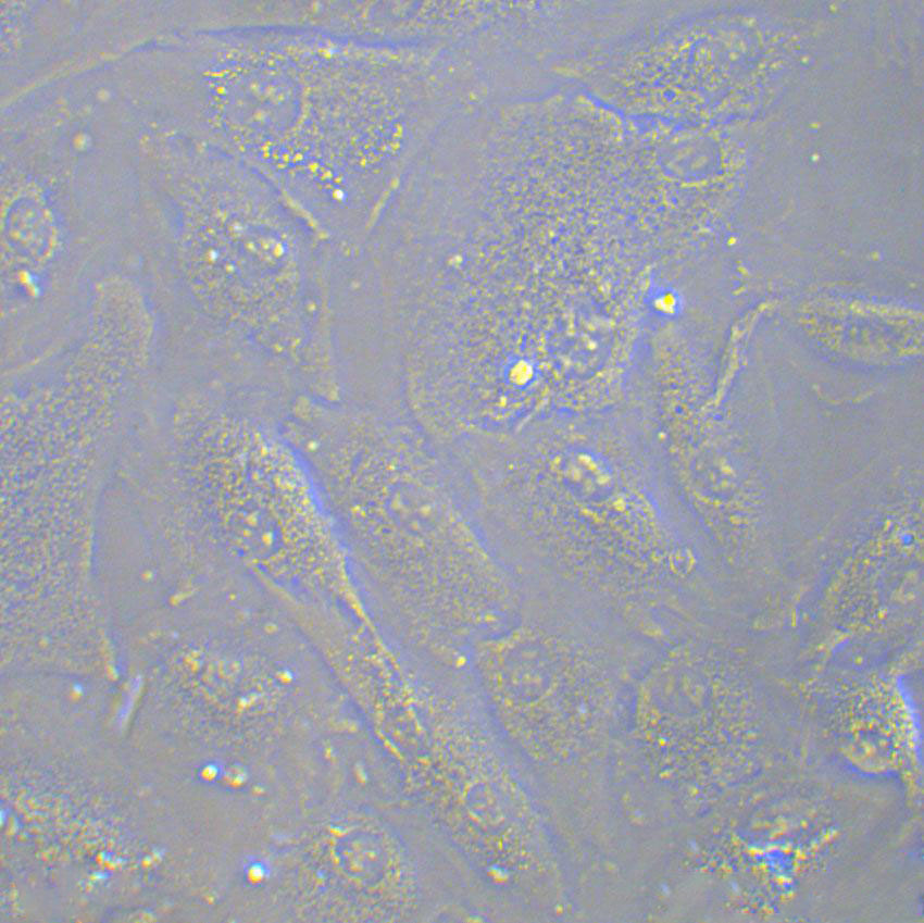 MCF-7B Cell|人乳腺癌细胞