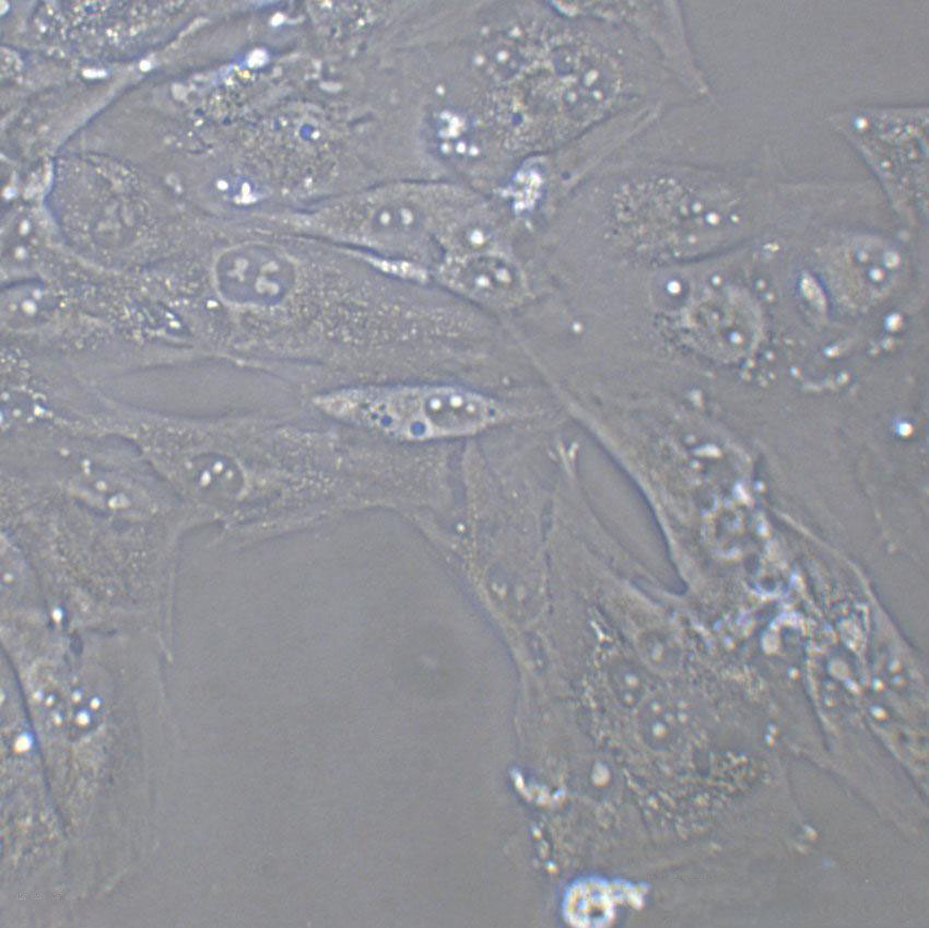 MC57G Cell|小鼠纤维肉瘤细胞