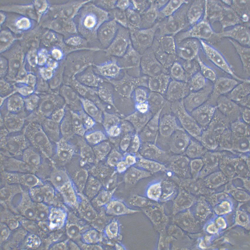 4-1st Cell|人胃癌细胞