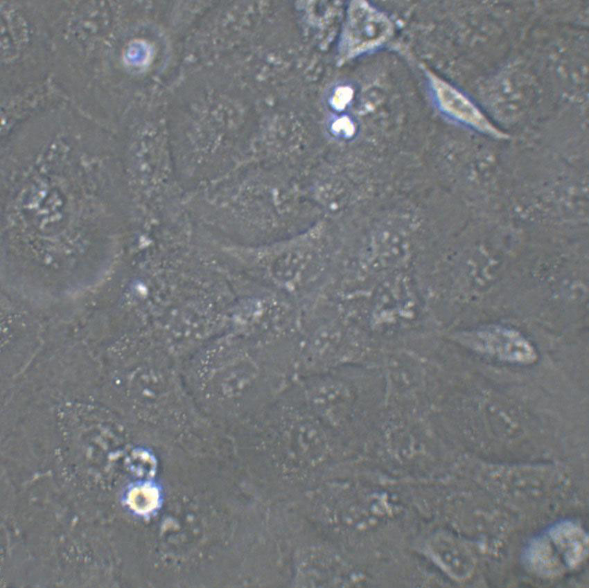 BT-474 Cell|人乳腺导管瘤细胞