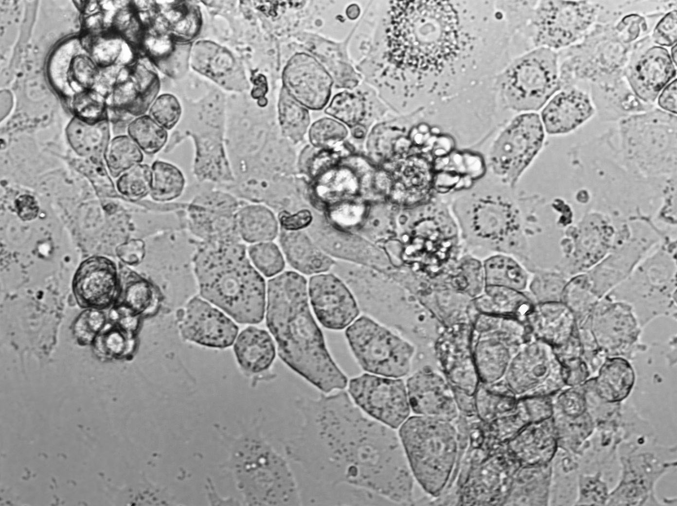 BC-009 Cell|人乳腺癌细胞