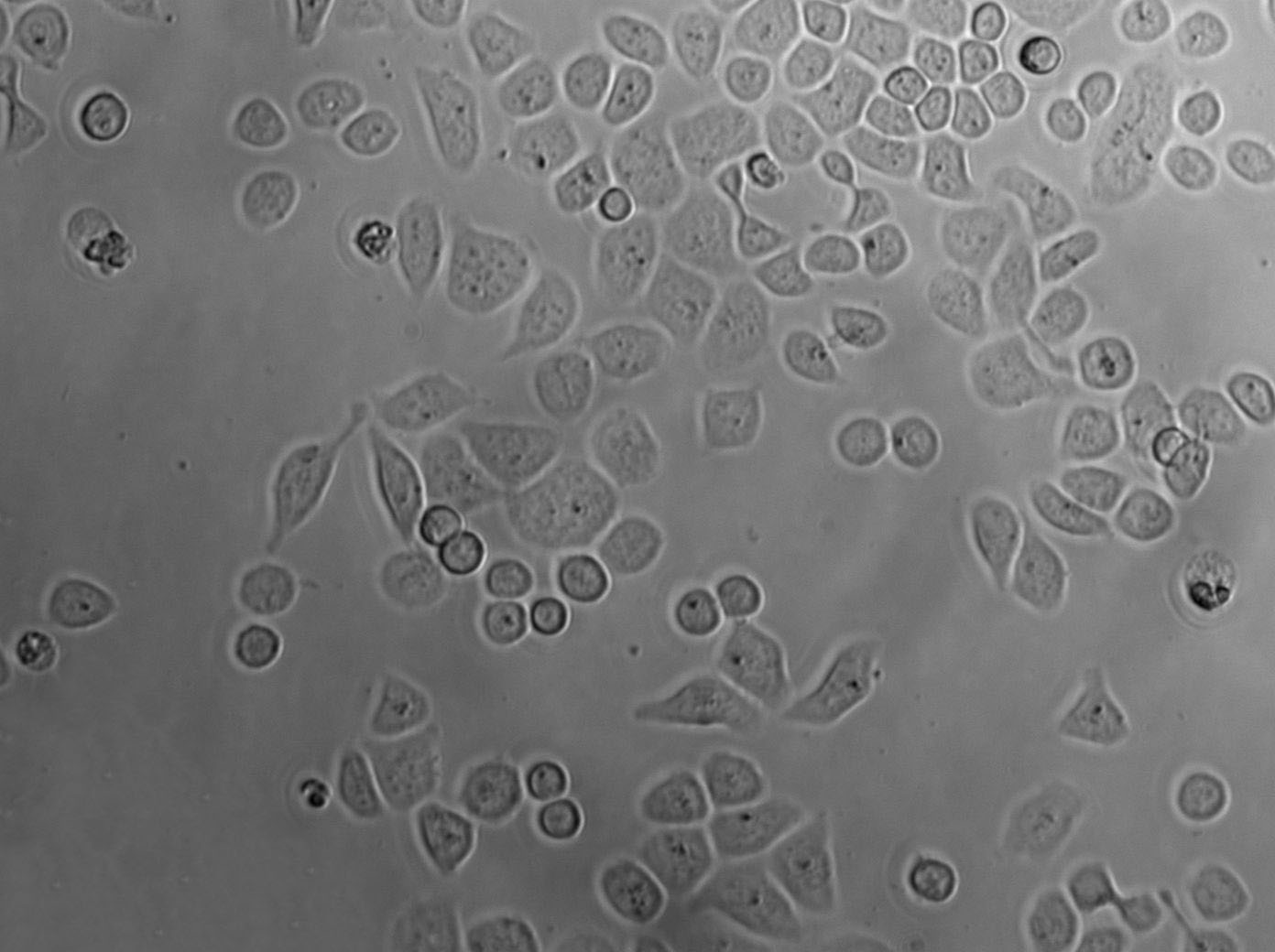 TKB-1 Cell|人肺癌细胞