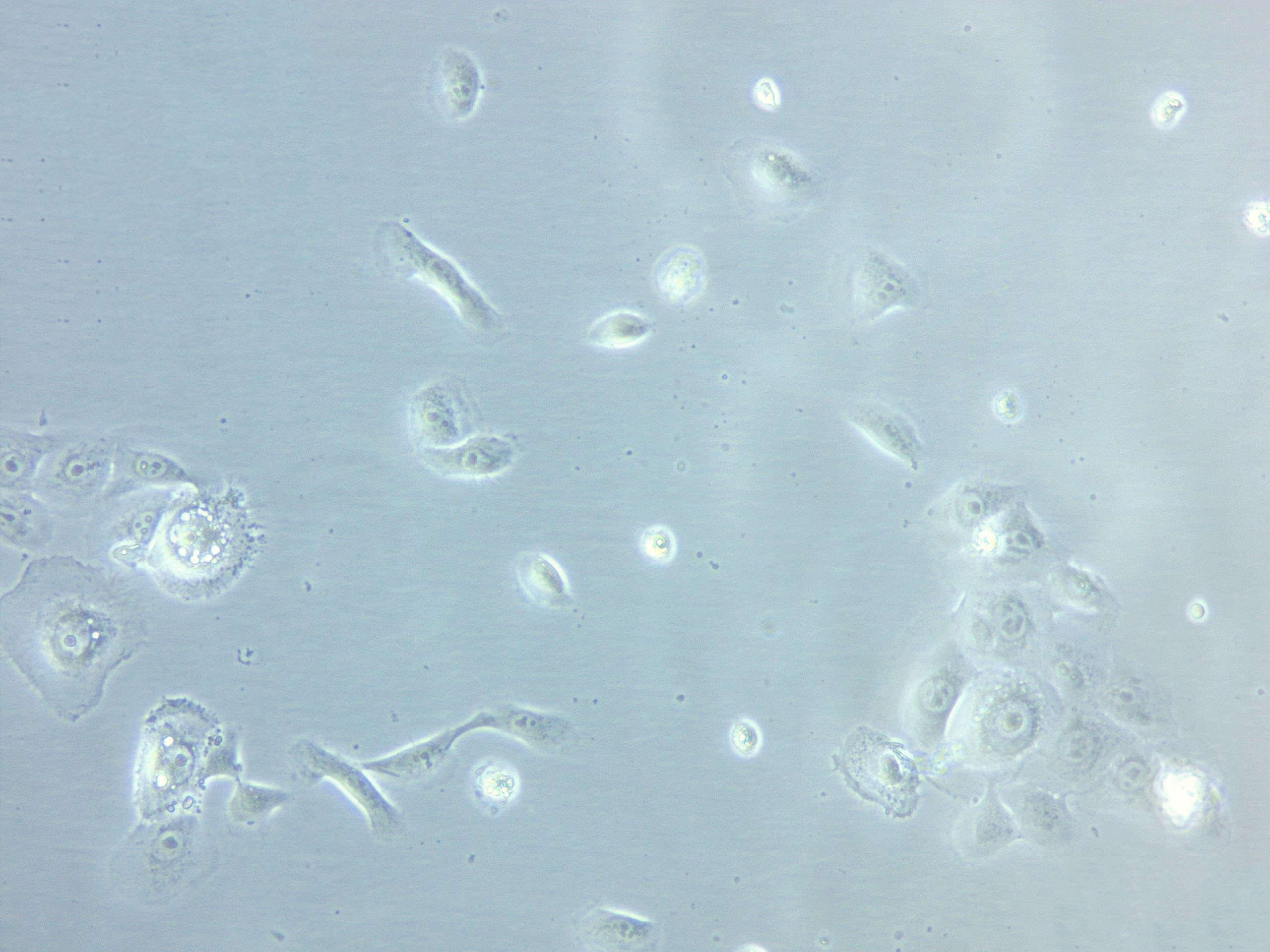 CBRH-7919 Cell|大鼠肝癌细胞