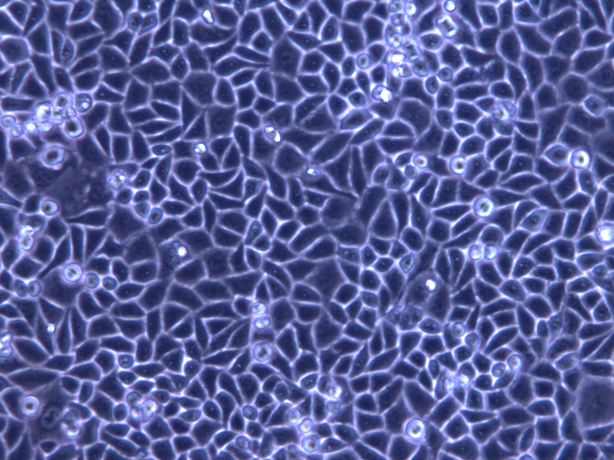 QG-56 Cell|人肺扁平上皮癌细胞