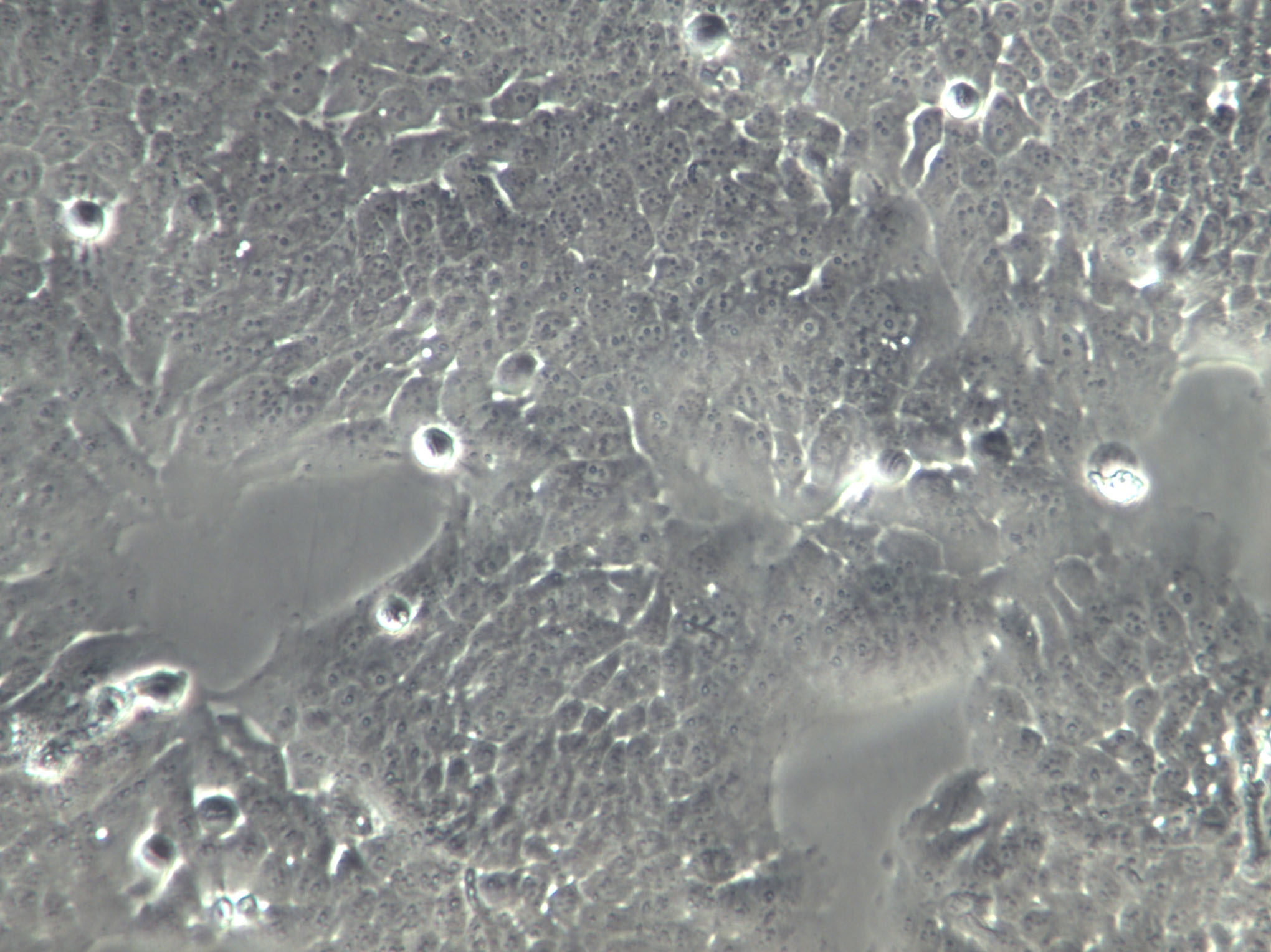 DoHH2 Cell|人胸腔积液滤泡中心母细胞