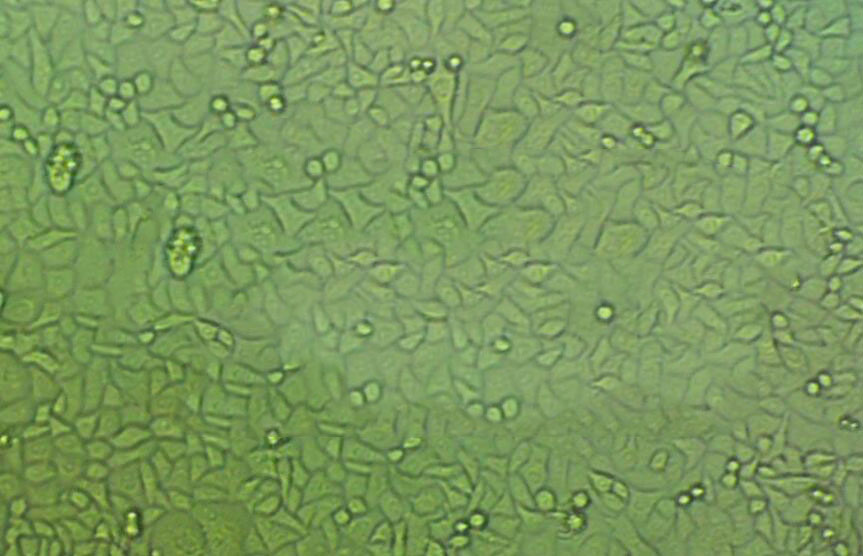 OC 316 Cell|人卵巢癌细胞