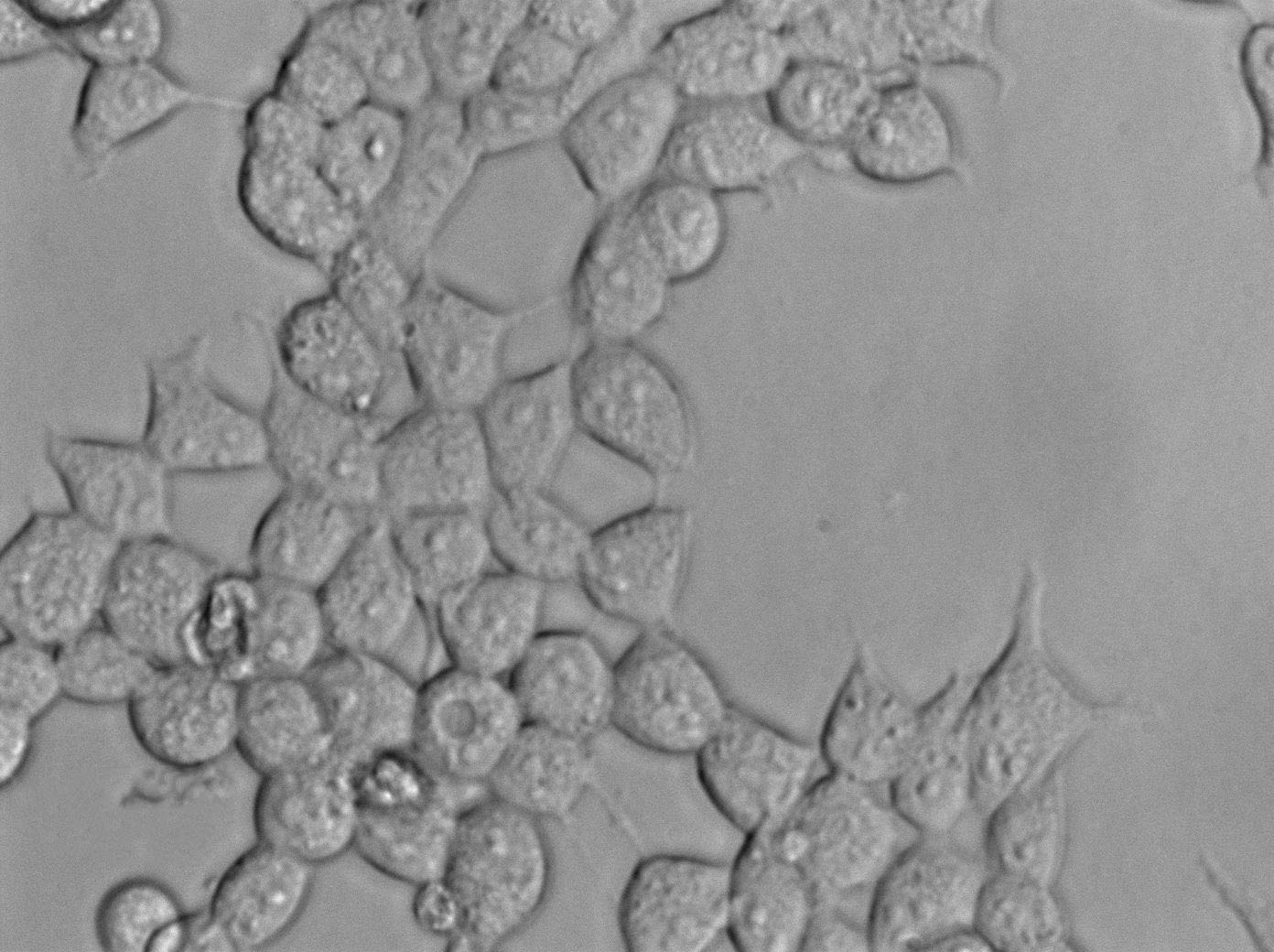 HEC-151 Cell|人子宫内膜癌细胞