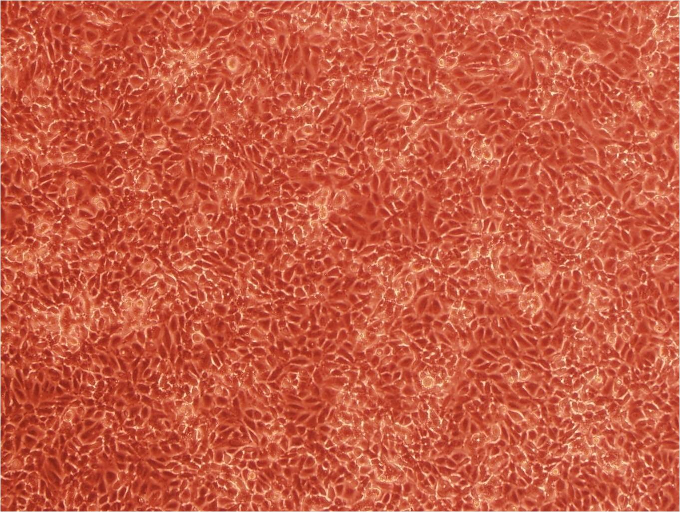FU-OV-1 Cell|人卵巢癌细胞