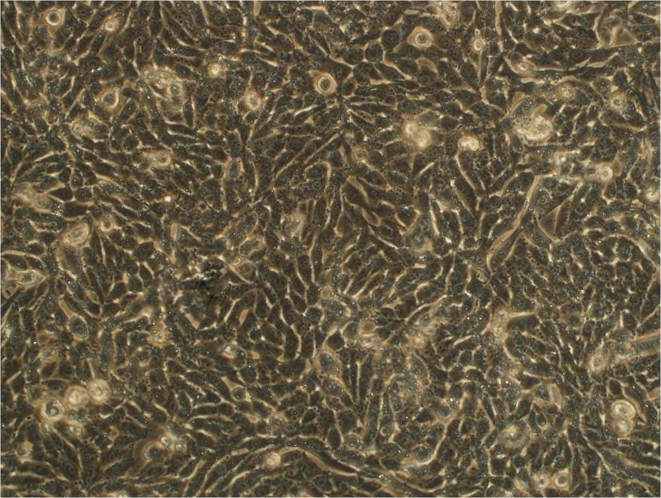 SK-N-BE(2)-M17 Cell|人成神经细胞