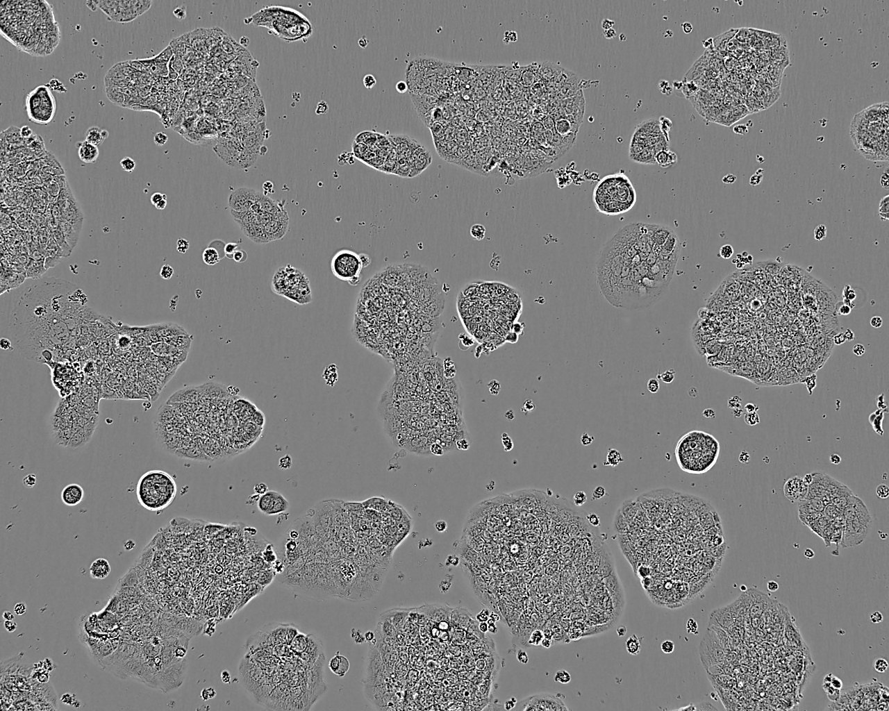 NCI-H1385 Cell|人肺癌细胞