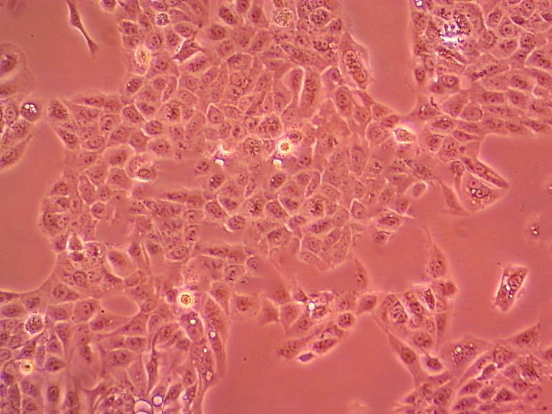 HCC1438 Cell|人肺癌细胞