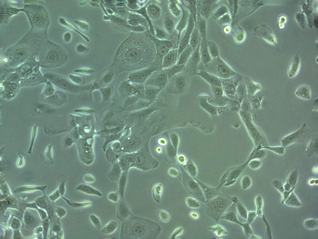 MGH-U3 Cell|人膀胱癌细胞