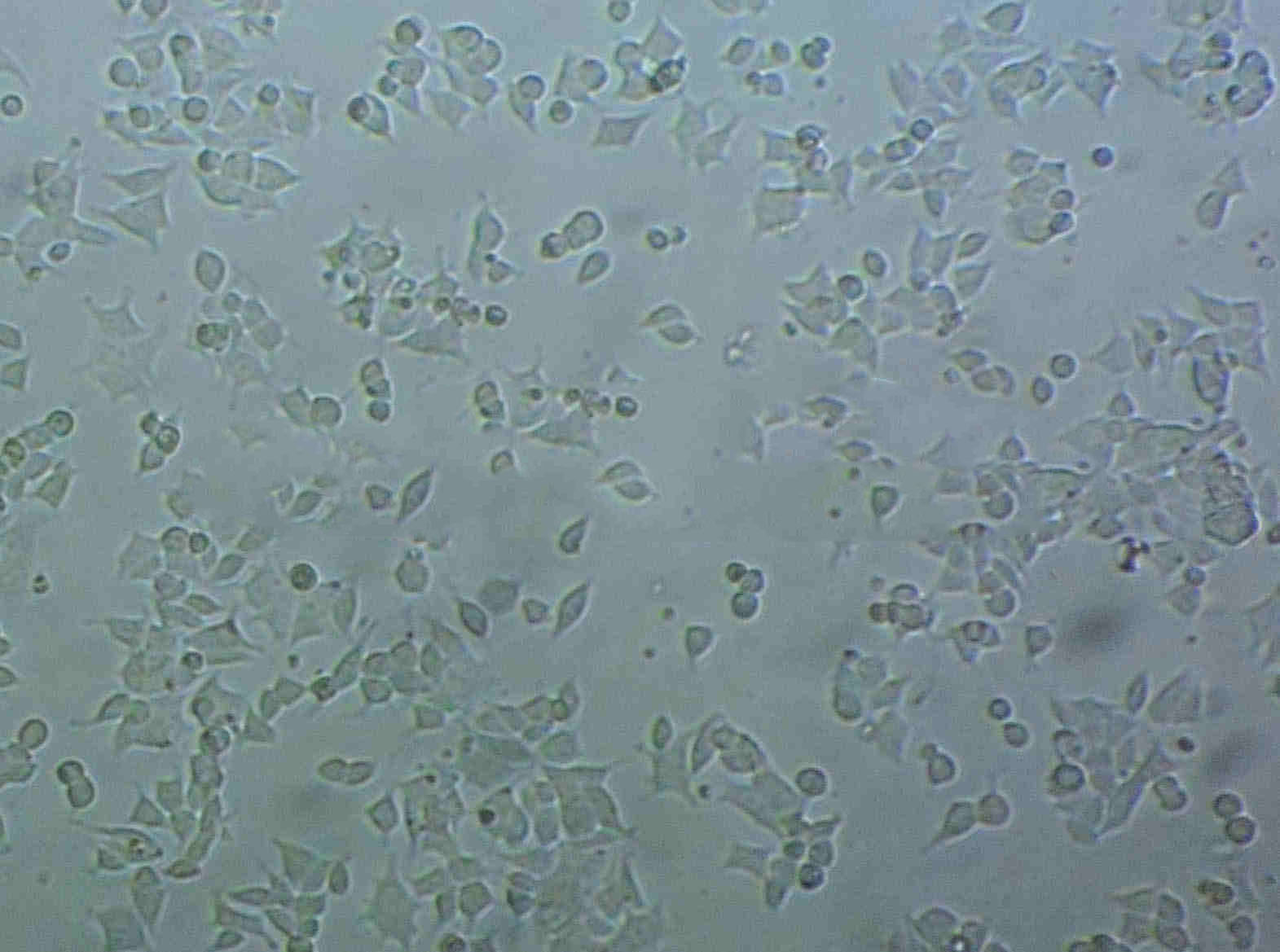 NCI-H295 Cell|人肾上腺皮质癌细胞