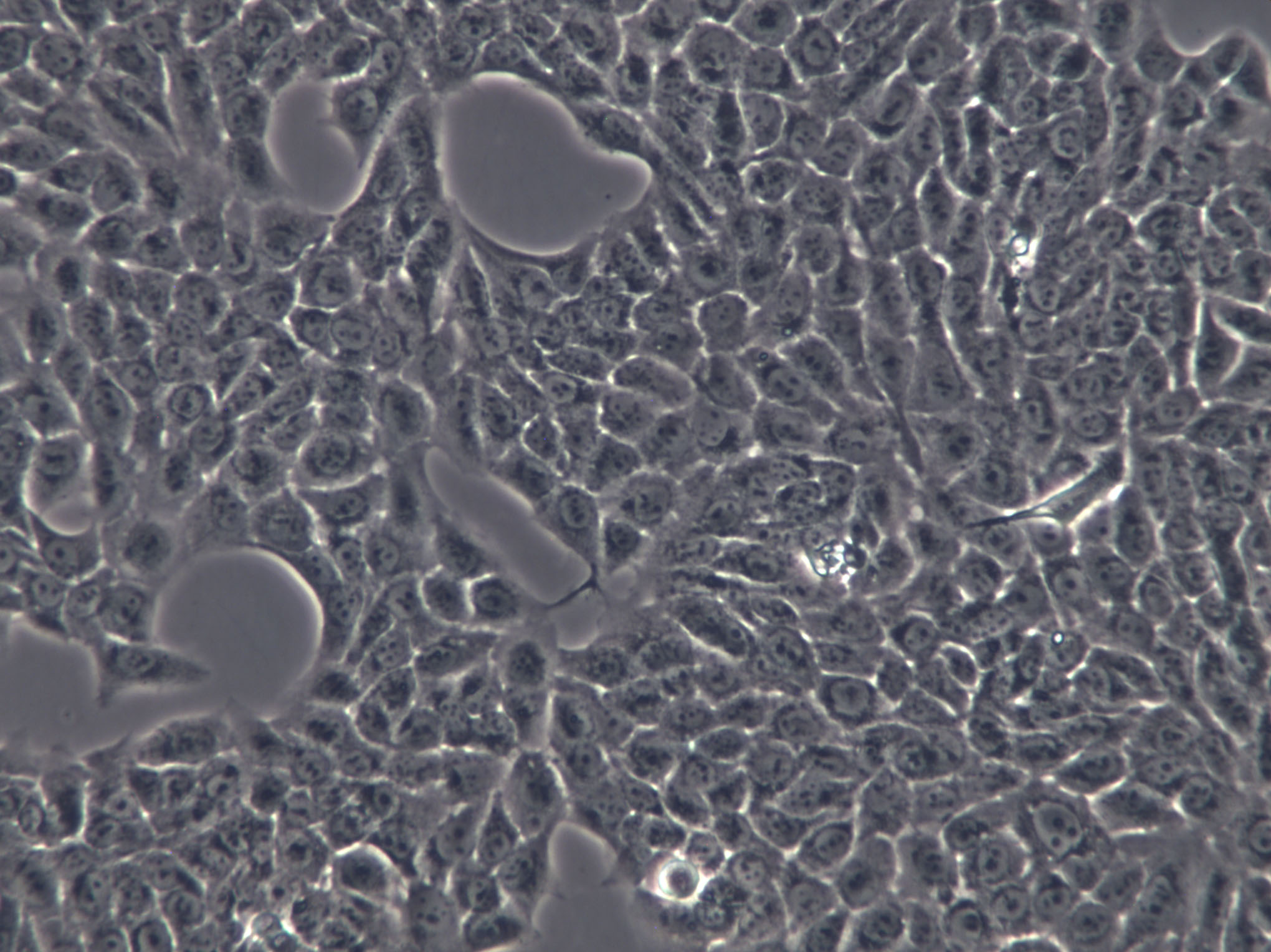 RPMI-1846 Cell|人黑色素瘤细胞