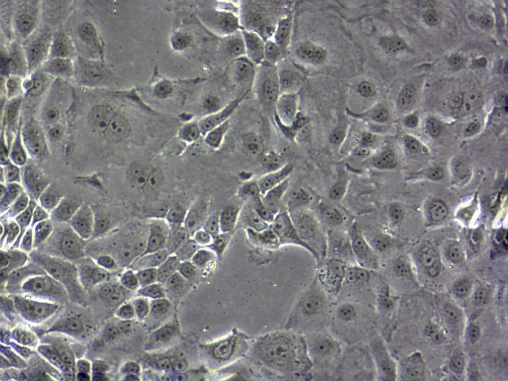 SNU-C2B Cell|人结直肠癌细胞