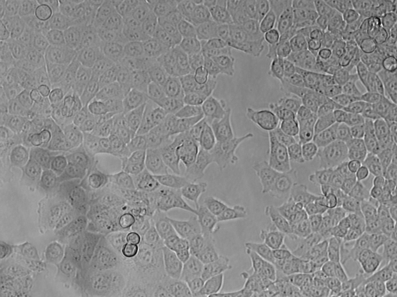 NCI-H676B Cell|人肺腺癌细胞