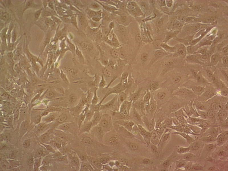 NCI-H1522 Cell|人肺癌细胞