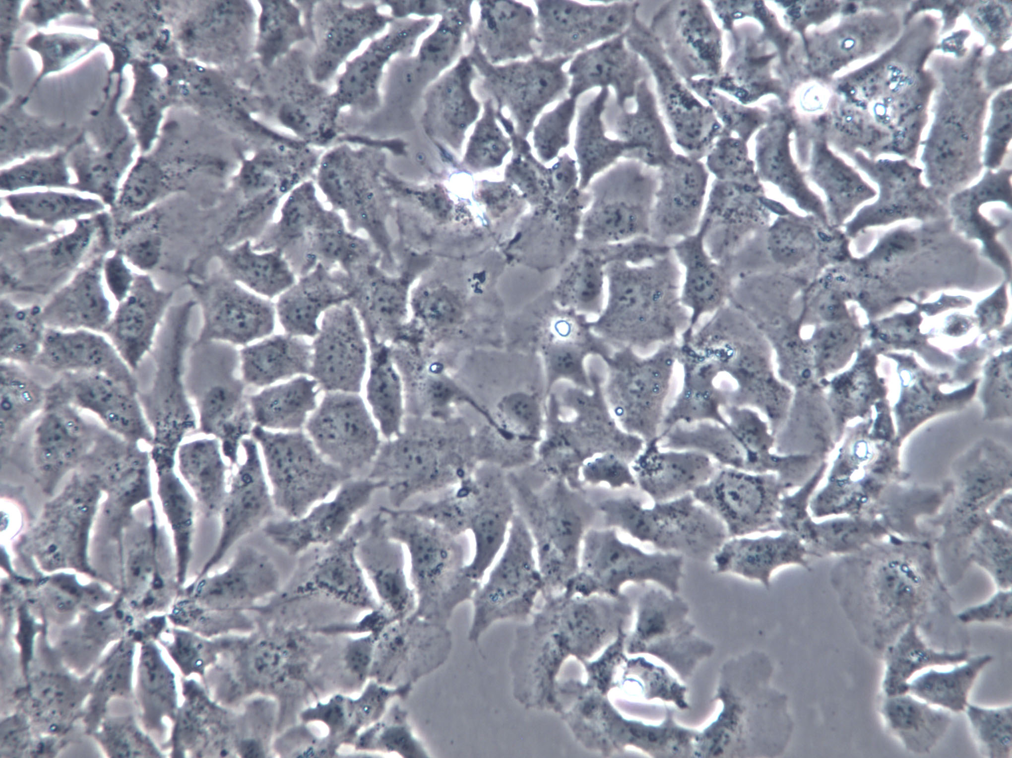 UK Pan-1 Cell|人胰腺导管上皮癌细胞