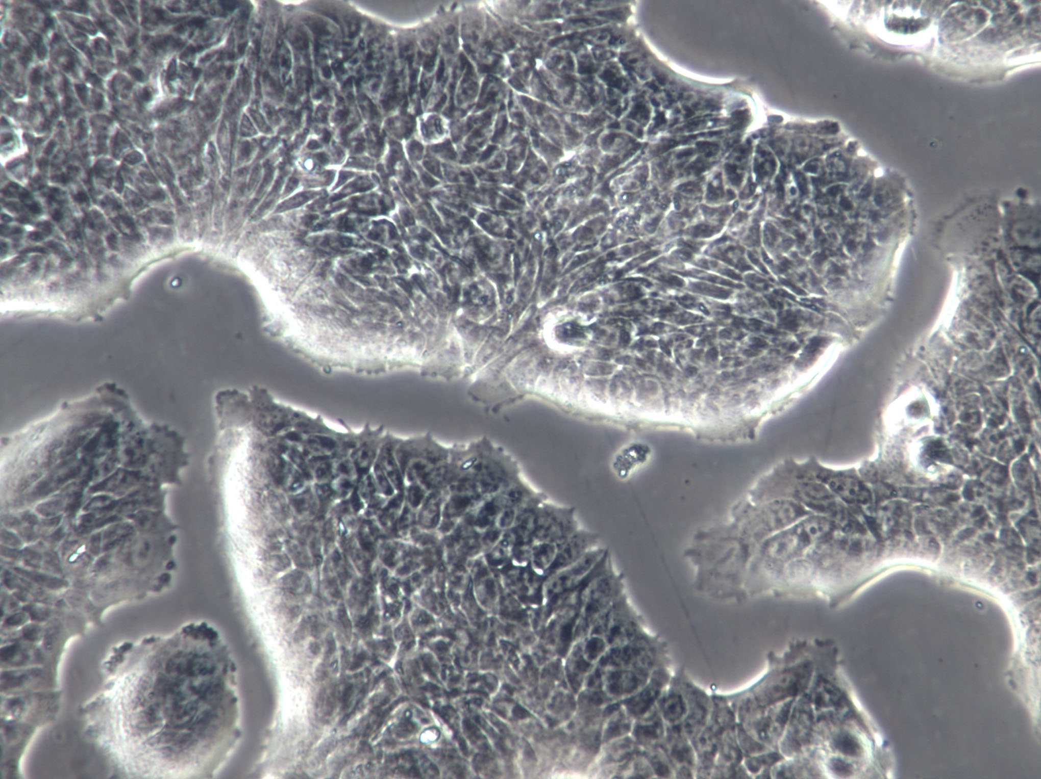 SW13 Cell|人肾上腺皮质瘤细胞