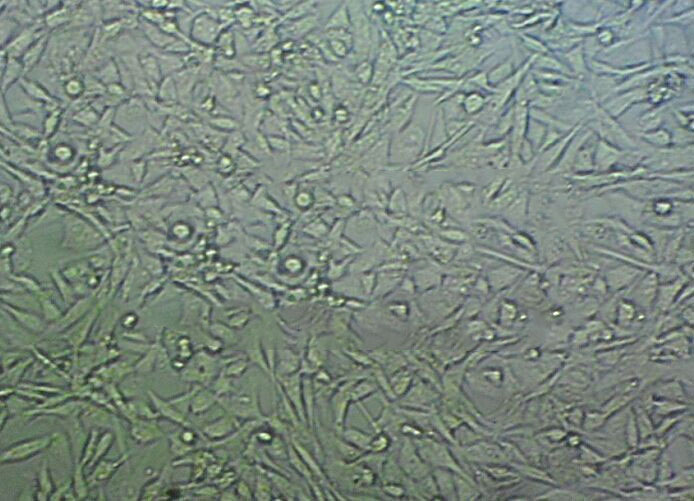 U-87MG ATCC Cell|人脑星形胶质母细胞瘤细胞