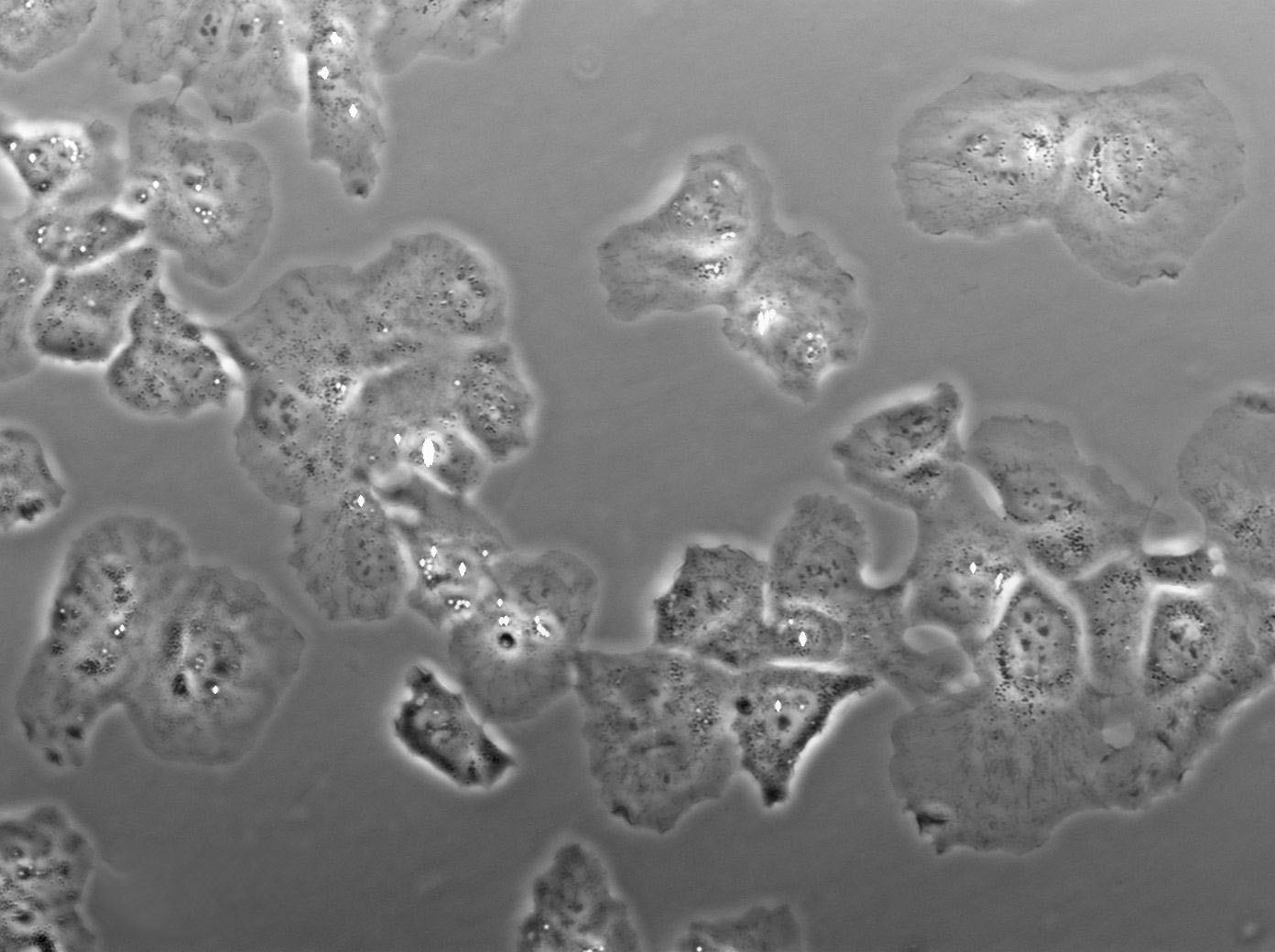 RCC10 Cell|人肾癌细胞
