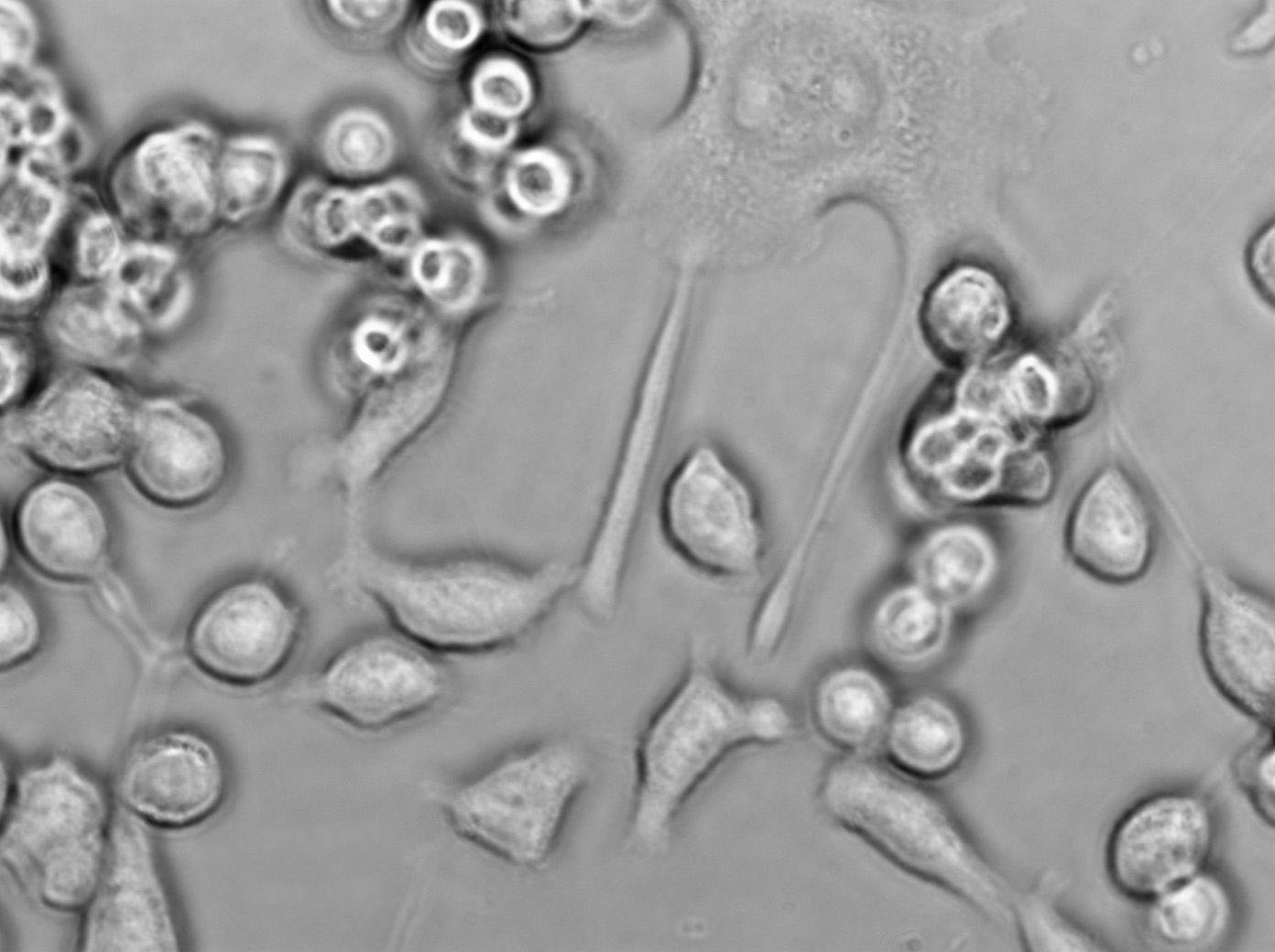 RCC23 Cell|人肾透明细胞癌细胞
