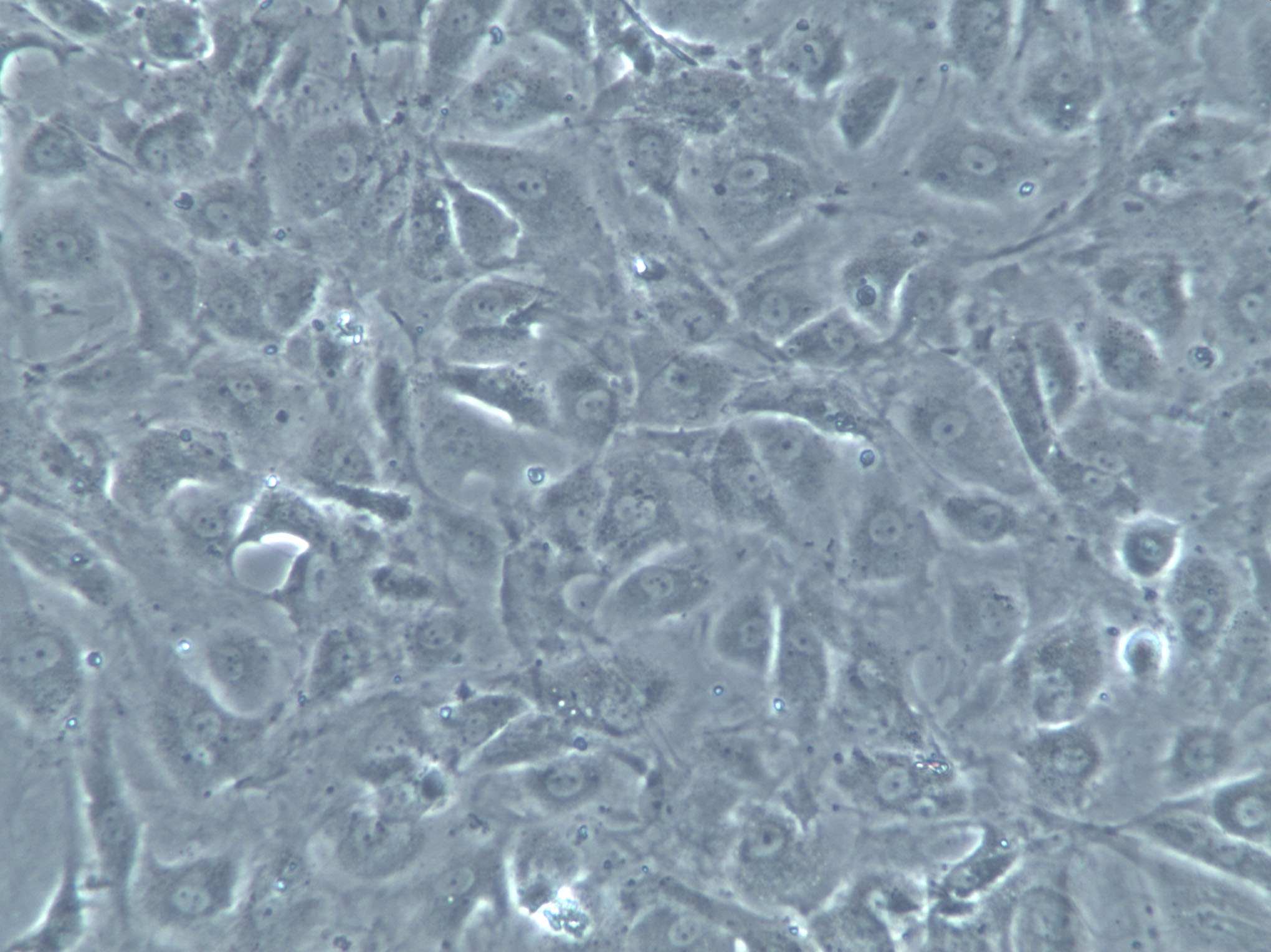 ELD-1 Cell|人朗格汉斯细胞型树突状细胞