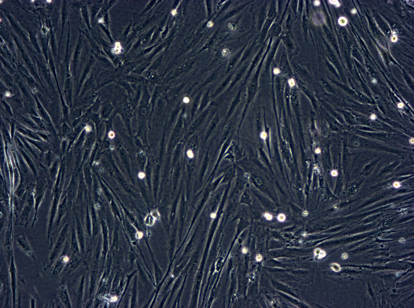 HFLS-RA Cell|类风湿关节炎成纤维样滑膜细胞