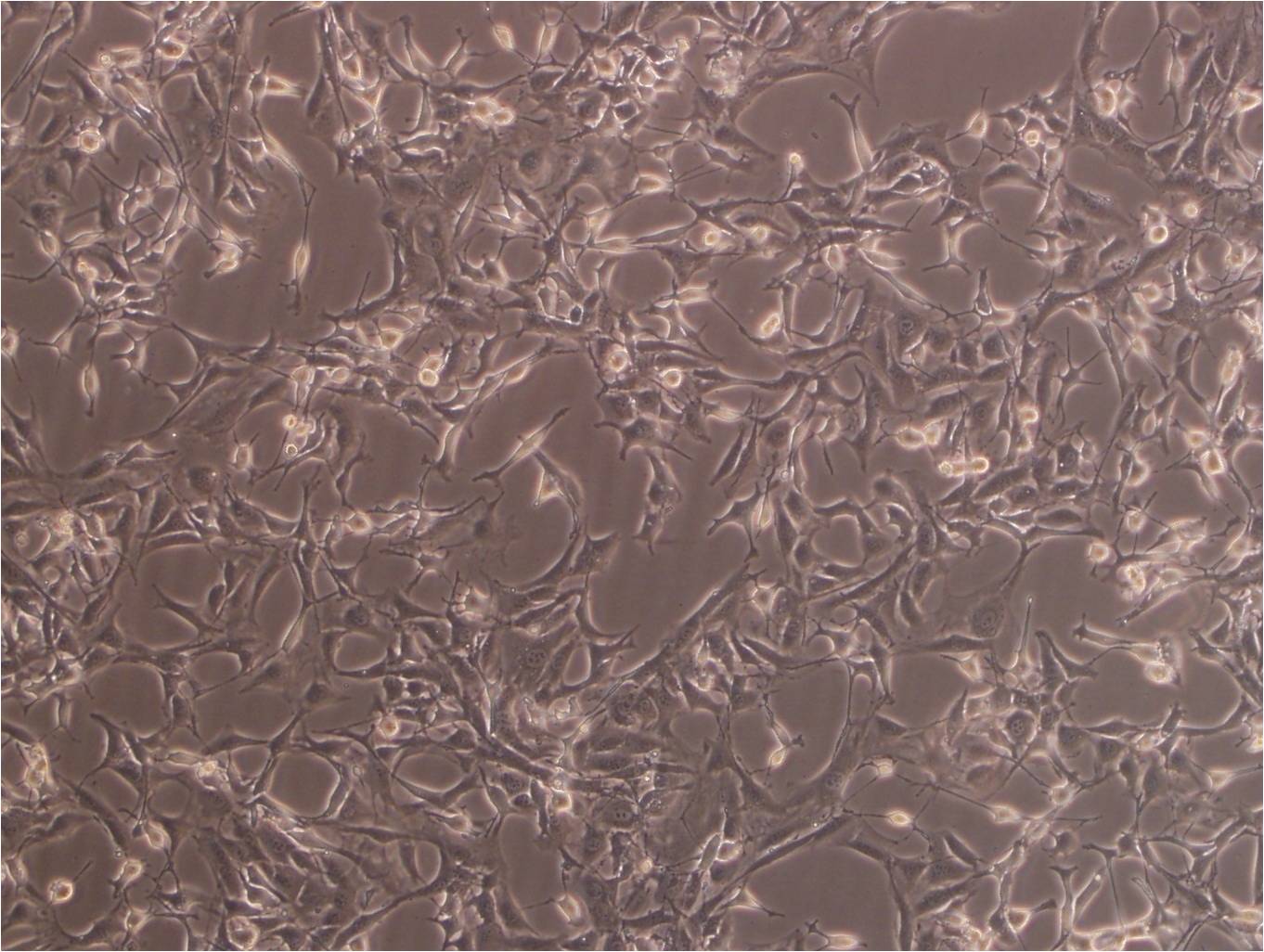 NRK-49F Cell|大鼠正常肾成纤维细胞