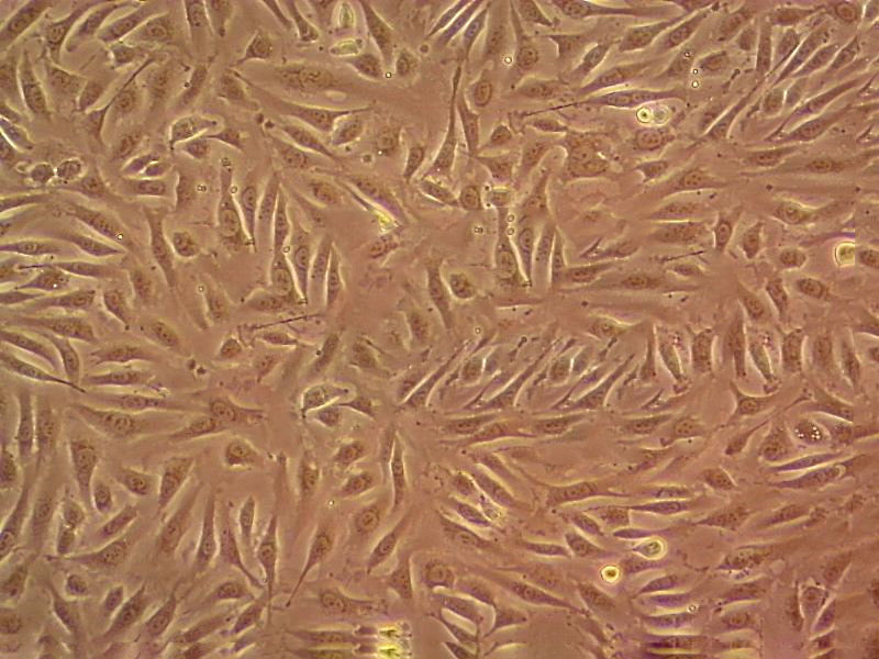 CCD-19Lu Cell|人肺成纤维细胞