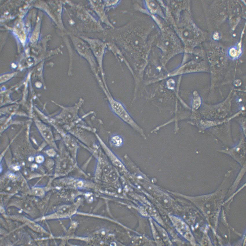 CCD-1112sk Cell|人包皮成纤维细胞