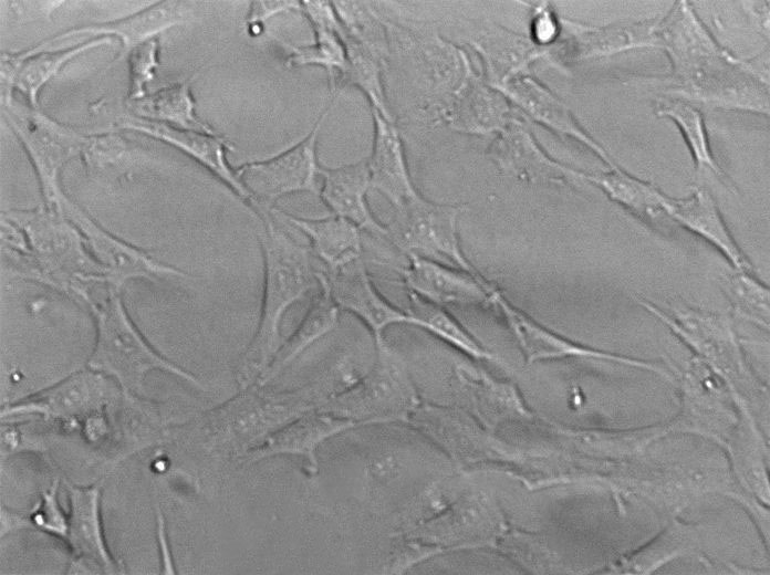 NCTC clone 929 Cell|小鼠成纤维细胞