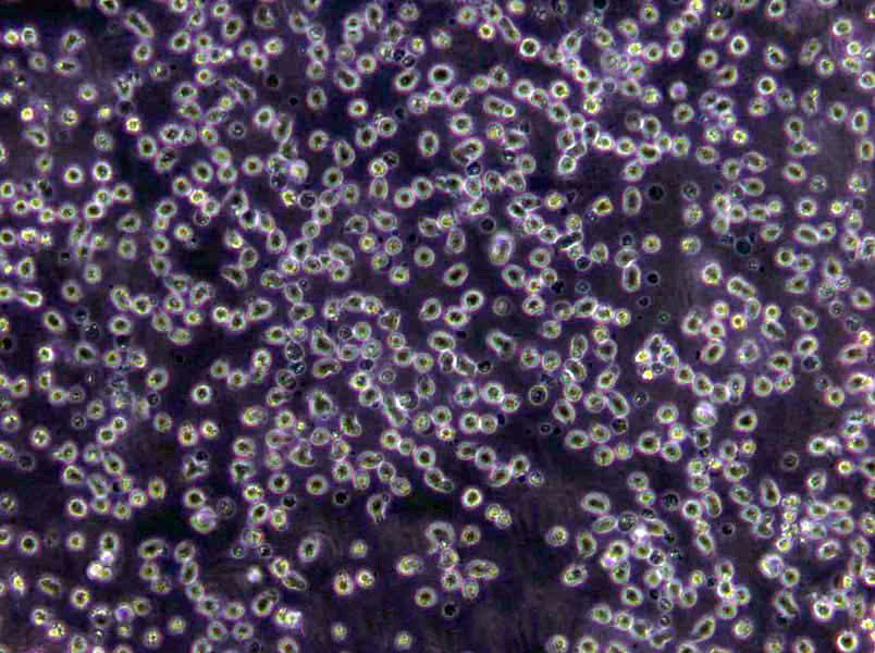Daudi Lymphoblast Cell|人Burkkit淋巴瘤传代细胞(有STR鉴定)