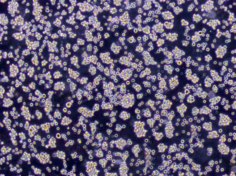 CA46 Lymphoblast Cell|人burkitt淋巴瘤传代细胞(有STR鉴定)