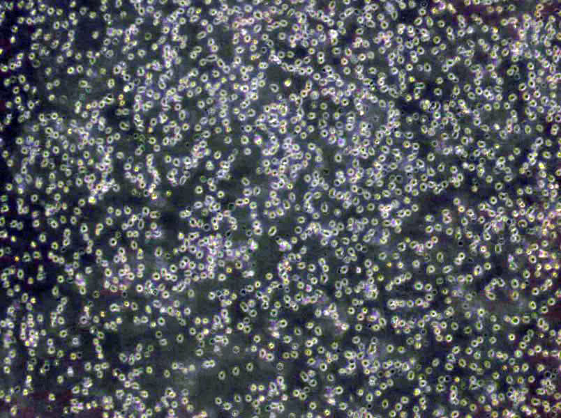 MT-4 Lymphoblast Cell|人急性淋巴母细胞白血病传代细胞(有STR鉴定)