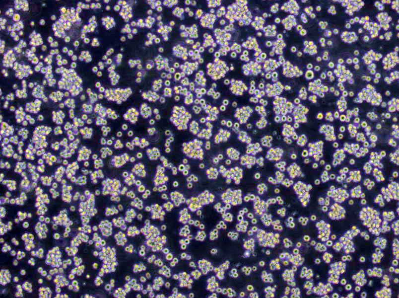 REC-1 Lymphoblast Cell|人淋巴瘤传代细胞(有STR鉴定)