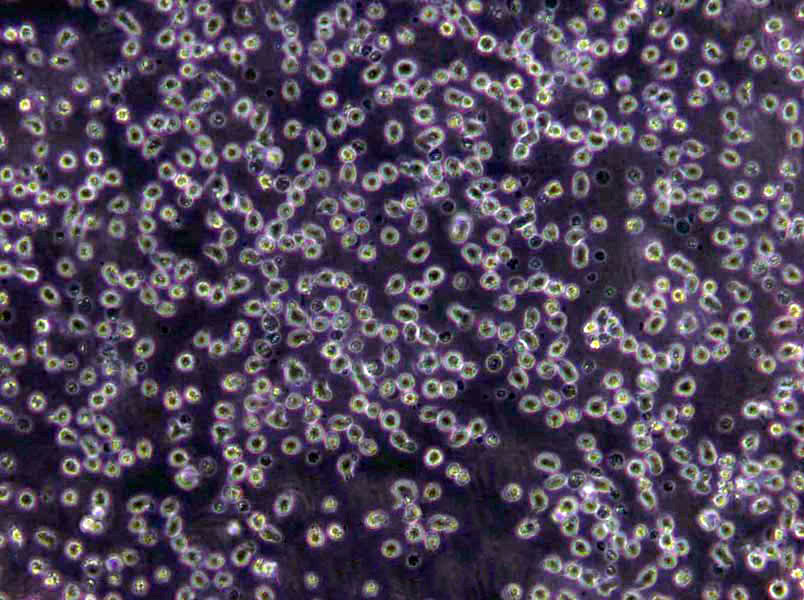 MT-2 Lymphoblast Cell|人淋巴瘤传代细胞(有STR鉴定)