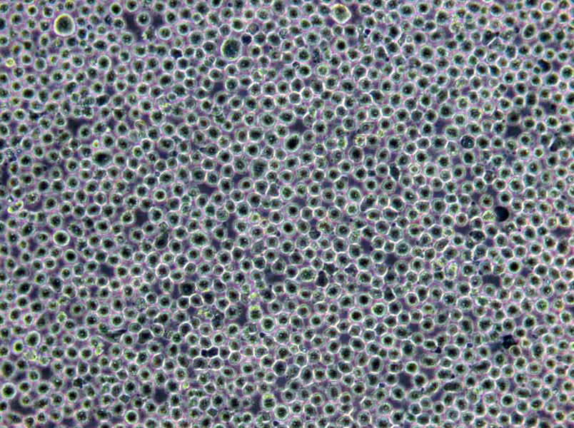 Ku812F Lymphoblast Cell|人外周血嗜碱性白血病传代细胞(有STR鉴定)