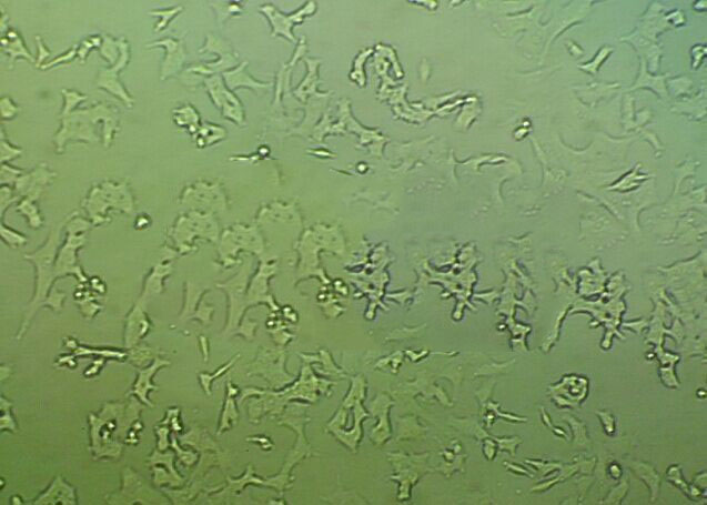 RBE Epithelial Cell|人胆管癌传代细胞(有STR鉴定)