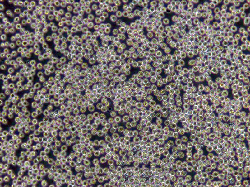 OCI-AML-3 Lymphoblast Cell|人急性髓细胞性白血病传代细胞(有STR鉴定)