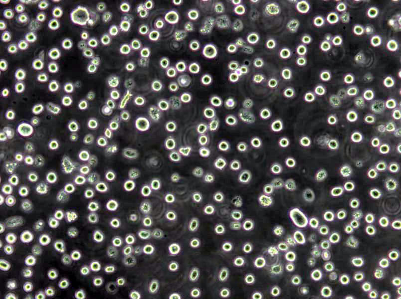 A20 Lymphoblast Cell|小鼠B细胞淋巴瘤传代细胞(有STR鉴定)