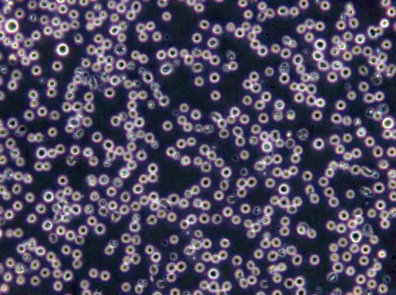 Karpas-299 Lymphoblast Cell|人间变性大细胞淋巴瘤传代细胞(有STR鉴定)