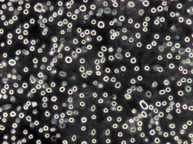 OCI-Ly3 Lymphoblast Cell|人弥漫大B细胞淋巴瘤传代细胞(有STR鉴定)