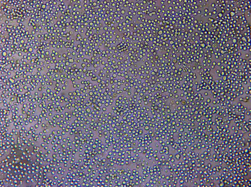 NK-92MI Lymphoblast Cell|人恶性非霍奇金淋巴瘤患者NK传代细胞(有STR鉴定)