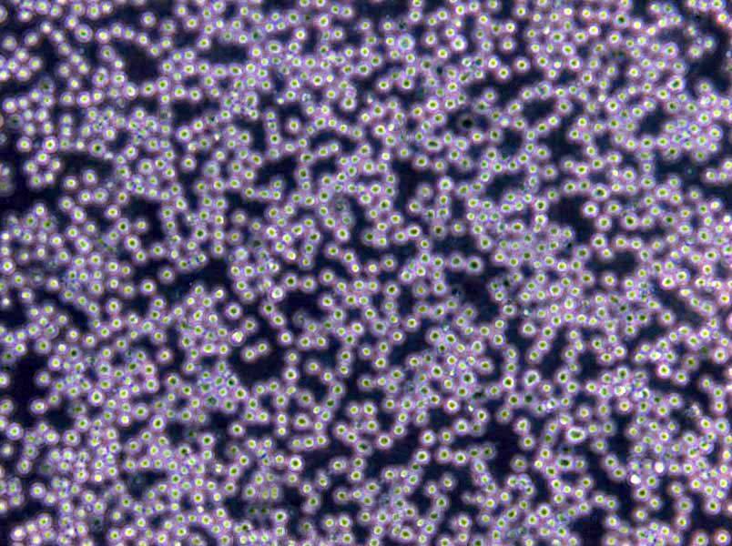 OCI-Ly10 Lymphoblast Cell|人弥漫大B细胞淋巴瘤传代细胞(有STR鉴定)