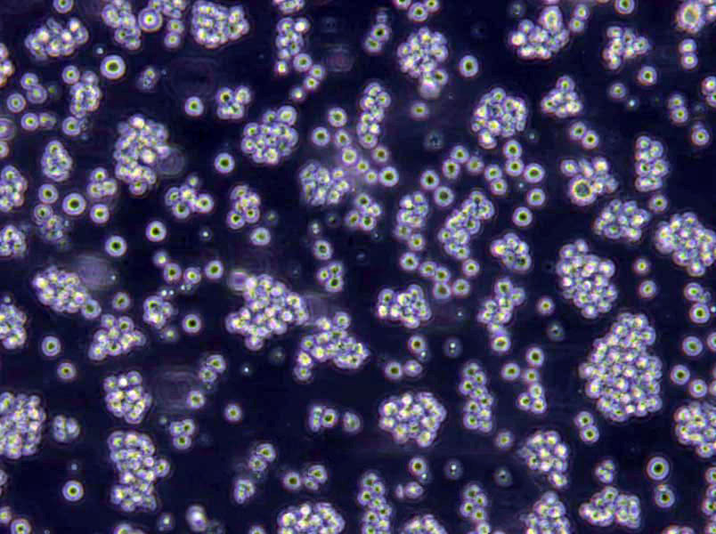 OCI-Ly1 Lymphoblast Cell|人弥漫大B淋巴瘤传代细胞(有STR鉴定)