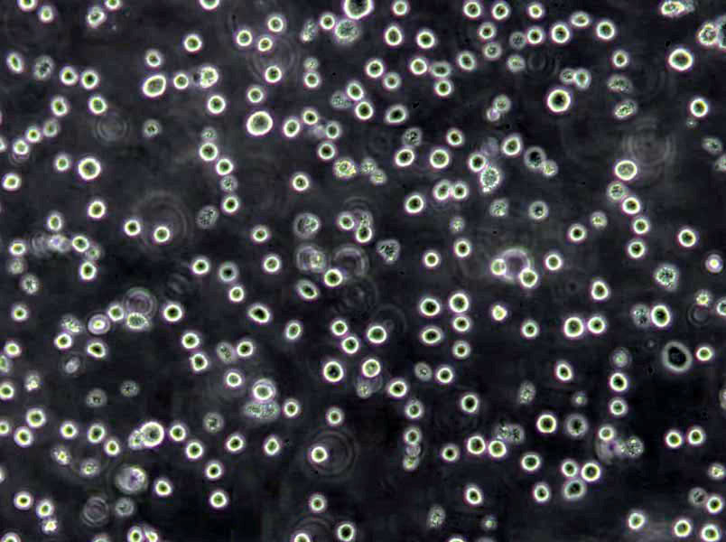 OCI-Ly19 Lymphoblast Cell|人弥漫大B淋巴瘤传代细胞(有STR鉴定)