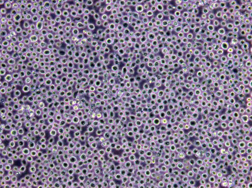AHH-1 Lymphoblast Cell|人外周血B淋巴传代细胞(有STR鉴定)